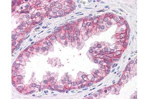Anti-CTNNA1 antibody IHC of human prostate. (CTNNA1 anticorps  (AA 871-883))