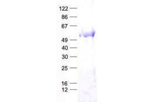 Validation with Western Blot