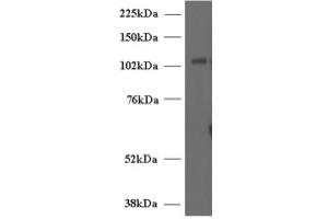 Image no. 1 for anti-Unc-13 Homolog D (UNC13D) (Internal Region) antibody (ABIN374716) (UNC13D anticorps  (Internal Region))