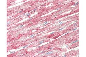 Human, Heart: Formalin-Fixed Paraffin-Embedded (FFPE).