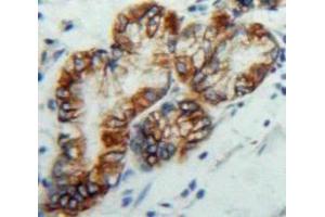 Used in DAB staining on fromalin fixed paraffin-embedded Stomach tissue