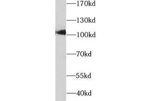 Western blot analysis of rat liver tissue subjected to SDS-PAGE, using SARDH antibody (1/1000 dilution). (SARDH anticorps)