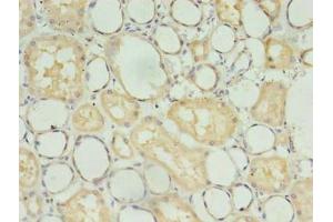 Immunohistochemistry of paraffin-embedded human kidney tissue using ABIN7173734 at dilution of 1:100 (TBCB anticorps  (AA 1-244))