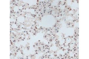 Immunohistochemistry of paraffin-embedded Mouse lung using ZNF416 Polyclonal Antibody at dilution of 1:100 (40x lens). (ZNF416 anticorps)