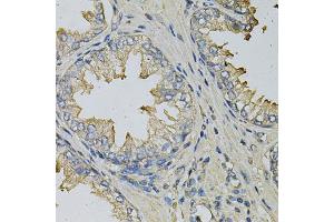 Immunohistochemistry of paraffin-embedded human prostate using LITAF Antibody (ABIN5973182) at dilution of 1/100 (40x lens). (LITAF anticorps)