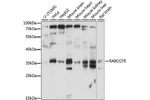Western blot analysis of extracts of various cell lines, using RABGGTB antibody (ABIN7269784) at 1:1000 dilution. (RABGGTB anticorps  (AA 1-331))