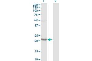 Western Blot analysis of GLO1 expression in transfected 293T cell line by GLO1 polyclonal antibody (A01). (GLO1 anticorps  (AA 1-184))