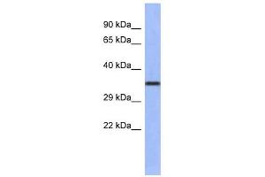 WNT4 antibody used at 1 ug/ml to detect target protein. (WNT4 anticorps  (Middle Region))
