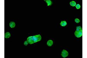 Immunofluorescence staining of MCF-7 cells with ABIN7168018 at 1:100, counter-stained with DAPI. (RHOB anticorps  (AA 1-196))