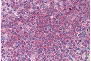 Human Spleen: Formalin-Fixed, Paraffin-Embedded (FFPE) (HYI anticorps  (AA 1-218))