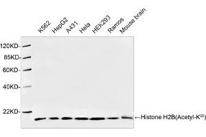 Western blot analysis of cell and tissue lysates using 1 µg/mL Antibodies-Online Rabbit Anti-Histone H2B (Acetyl-K20) Polyclonal Antibody (ABIN398911) The signal was developed with IRDyeTM 800 Conjugated Goat Anti-Rabbit IgG.