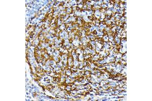 Immunohistochemistry of paraffin-embedded human tonsil using Casein Kinase 1 alpha (Casein Kinase 1 alpha (CSNK1)) antibody (6225) at dilution of 1:100 (40x lens).