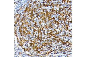 Immunohistochemistry of paraffin-embedded human tonsil using Casein Kinase 1 alpha (Casein Kinase 1 alpha (CSNK1)) antibody (6225) at dilution of 1:100 (40x lens). (CSNK1A1 anticorps  (AA 100-200))