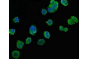 Immunofluorescence staining of PC3 cells with ABIN7154871 at 1:106, counter-stained with DAPI.