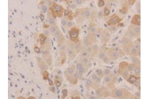 DAB staining on IHC-P; Samples: Human Liver Tissue (NEU1 anticorps  (AA 47-415))