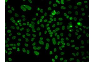 Immunofluorescence analysis of A549 cell using PLCXD2 antibody. (PLCXD2 anticorps)