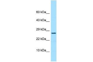 Host: Rabbit Target Name: PRDX4 Sample Type: COLO205 Whole Cell lysates Antibody Dilution: 1. (Peroxiredoxin 4 anticorps  (N-Term))