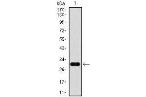 Western blot analysis using GPC3 mAb against human GPC3 (AA: 55-200) recombinant protein. (Glypican 3 anticorps)