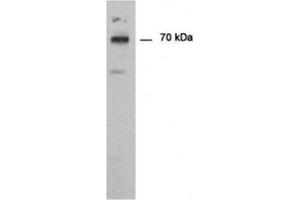Immunodetection of PAD type 1 using PADI1 antibody in Human epedermis as a 70 kDa protein. (PADI1 anticorps)