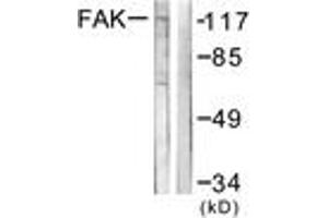 Western blot analysis of extracts from NIH-3T3 cells, using FAK (Ab-576) Antibody. (FAK anticorps  (AA 542-591))