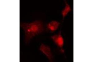 ABIN6275897 staining  Hela cells by IF/ICC. (INA anticorps  (Internal Region))