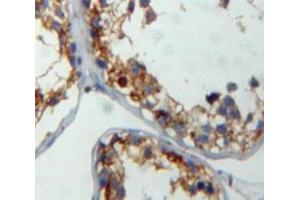 IHC-P analysis of testis tissue, with DAB staining. (CITED1 anticorps  (C-Term))