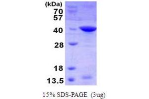 Livin beta (AA 1-280) protein (His tag)