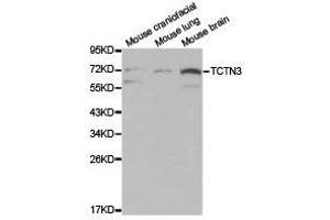 Western Blotting (WB) image for anti-Tectonic Family Member 3 (TCTN3) antibody (ABIN1875046) (TCTN3 anticorps)