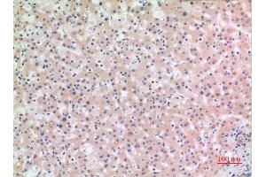 Immunohistochemistry (IHC) analysis of paraffin-embedded Human Liver, antibody was diluted at 1:100. (NLRP3 anticorps  (Internal Region))