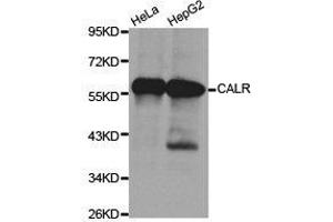 Western Blotting (WB) image for anti-Calreticulin (CALR) antibody (ABIN1871404) (Calreticulin anticorps)