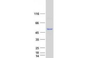 Validation with Western Blot