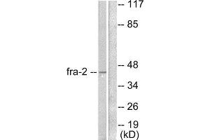 Western Blotting (WB) image for anti-FOS-Like Antigen 2 (FOSL2) (C-Term) antibody (ABIN1848552) (FOSL2 anticorps  (C-Term))