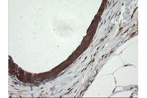 Image no. 1 for anti-Ubiquitin-Conjugating Enzyme E2G 2 (UBE2G2) antibody (ABIN1501634)