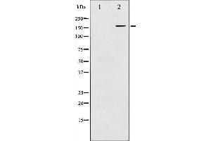 Western blot analysis of EGFR phosphorylation expression in Serum treated HuvEc whole cell lysates,The lane on the left is treated with the antigen-specific peptide. (EGFR anticorps  (pTyr1016))