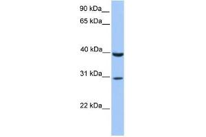 JAZF1 antibody used at 1. (JAZF1 anticorps  (C-Term))