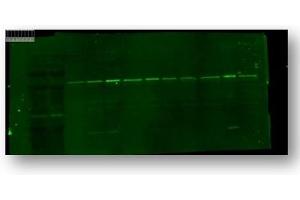 Western blot analysis of TRPC6 using anti-TRPC6 antibody (ABIN5518963).