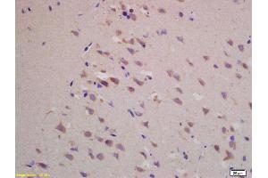 Formalin-fixed and paraffin embedded rat brain labeled with Rabbit Anti BACE1/ASP2 Polyclonal Antibody, Unconjugated (ABIN725705) at 1:200 followed by conjugation to the secondary antibody and DAB staining (BACE1 anticorps  (AA 401-501))