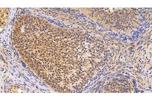 Detection of Surv in Human Ovary Tissue using Monoclonal Antibody to Survivin (Surv) (Survivin anticorps  (AA 1-142))