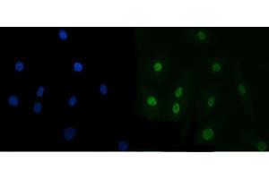 IF analysis of TRBP/TARBP2 using anti-TRBP/TARBP2 antibody (ABIN7600548). (TARBP2 anticorps  (AA 20-366))