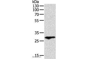 Western blot analysis of Human fetal lung tissue, using F3 Polyclonal Antibody at dilution of 1:400 (Tissue factor anticorps)