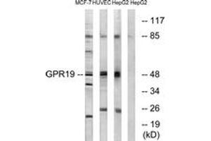 Western blot analysis of extracts from MCF-7/HuvEc/HepG2 cells, using GPR19 Antibody. (GPR19 anticorps  (AA 361-410))