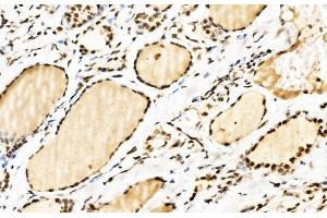 IHC analysis of SPHK1 using anti-SPHK1 antibody (ABIN7600168).