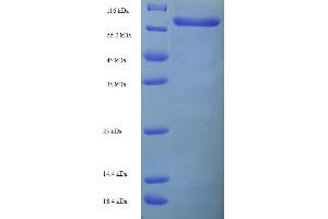 SDS-PAGE (SDS) image for Tripartite Motif Containing 21 (TRIM21) (AA 1-470), (full length) protein (His-SUMO Tag) (ABIN5711419)