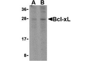 Western Blotting (WB) image for anti-BCL2-Like 1 (BCL2L1) (C-Term) antibody (ABIN1030287) (BCL2L1 anticorps  (C-Term))