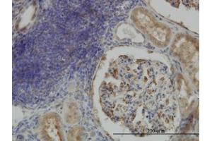Image no. 1 for anti-Cartilage Associated Protein (CRTAP) (AA 307-402) antibody (ABIN466169) (CRTAP anticorps  (AA 307-402))
