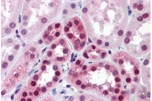 Human Kidney: Formalin-Fixed, Paraffin-Embedded (FFPE)