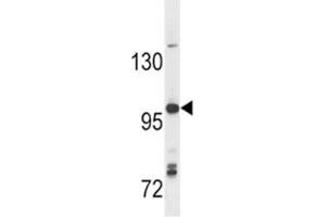 Anti-TLR7 antibody western blot analysis in Ramos lysate (TLR7 anticorps  (AA 98-128))