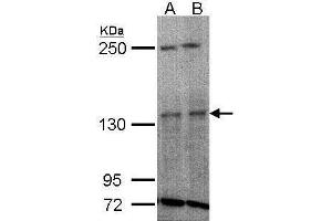 WB Image Sample(30 ug whole cell lysate) A:H1299 B:HeLa S3, 5% SDS PAGE antibody diluted at 1:1000 (TYK2 anticorps)