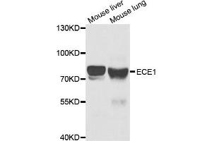 Western Blotting (WB) image for anti-Endothelin-Converting Enzyme 1 (ECE1) antibody (ABIN1876839) (ECE1 anticorps)