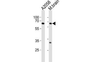 Western Blotting (WB) image for anti-Leucine Zipper, Putative Tumor Suppressor 1 (LZTS1) antibody (ABIN2997120) (LZTS1 anticorps)